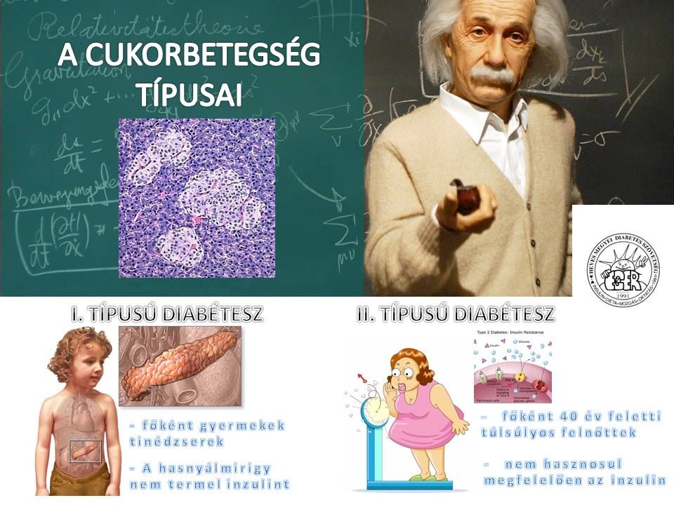 a cukorbetegség típusai)